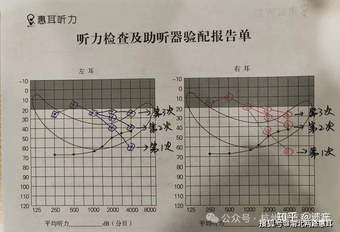 耳技能大比拼谁说耳朵只能听？